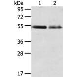 RHCG Antibody from Signalway Antibody (40211) - Antibodies.com