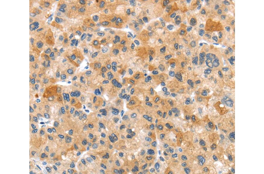 Immunohistochemistry - RHCG Antibody from Signalway Antibody (40211) - Antibodies.com