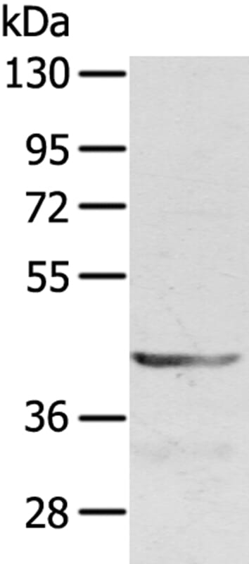 Gel: 8% SDS-PAGE Lysate: 40ug Jurkat cell. Primary antibody: 1/400 dilution Secondary antibody dilution: 1/8000Exposure time: 2 minutes