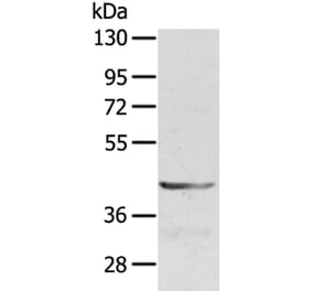 SDC3 Antibody from Signalway Antibody (40231) - Antibodies.com