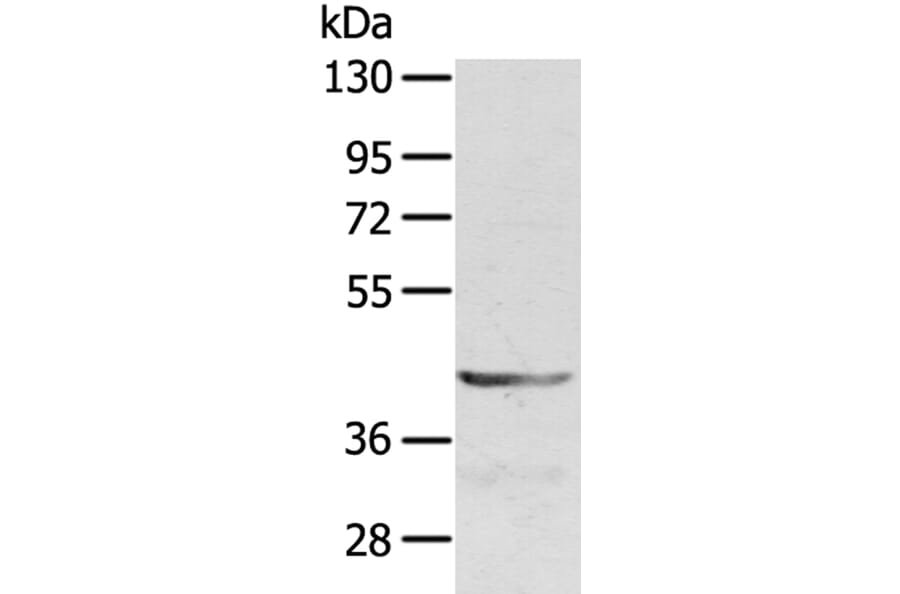 SDC3 Antibody from Signalway Antibody (40231) - Antibodies.com