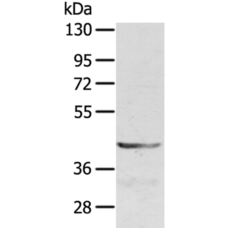 SDC3 Antibody from Signalway Antibody (40231) - Antibodies.com