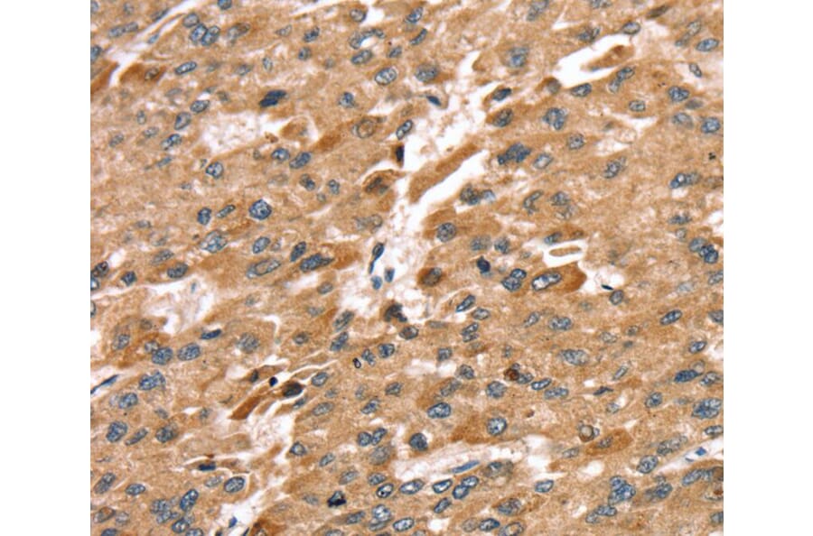 Immunohistochemistry - SDC3 Antibody from Signalway Antibody (40231) - Antibodies.com
