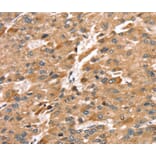 Immunohistochemistry - SDC3 Antibody from Signalway Antibody (40231) - Antibodies.com
