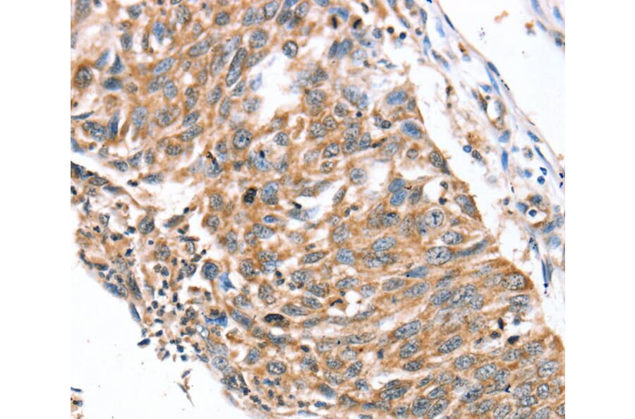 Immunohistochemistry - SDC3 Antibody from Signalway Antibody (40231) - Antibodies.com