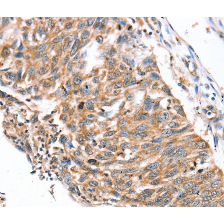 Immunohistochemistry - SDC3 Antibody from Signalway Antibody (40231) - Antibodies.com