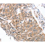 Immunohistochemistry - SDC3 Antibody from Signalway Antibody (40231) - Antibodies.com