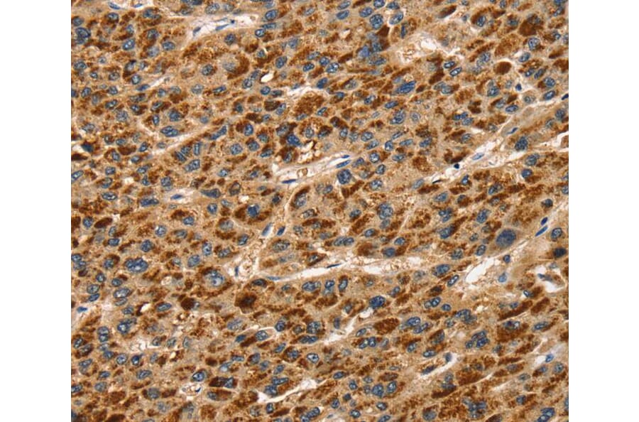 Immunohistochemistry - TLN1 Antibody from Signalway Antibody (40235) - Antibodies.com