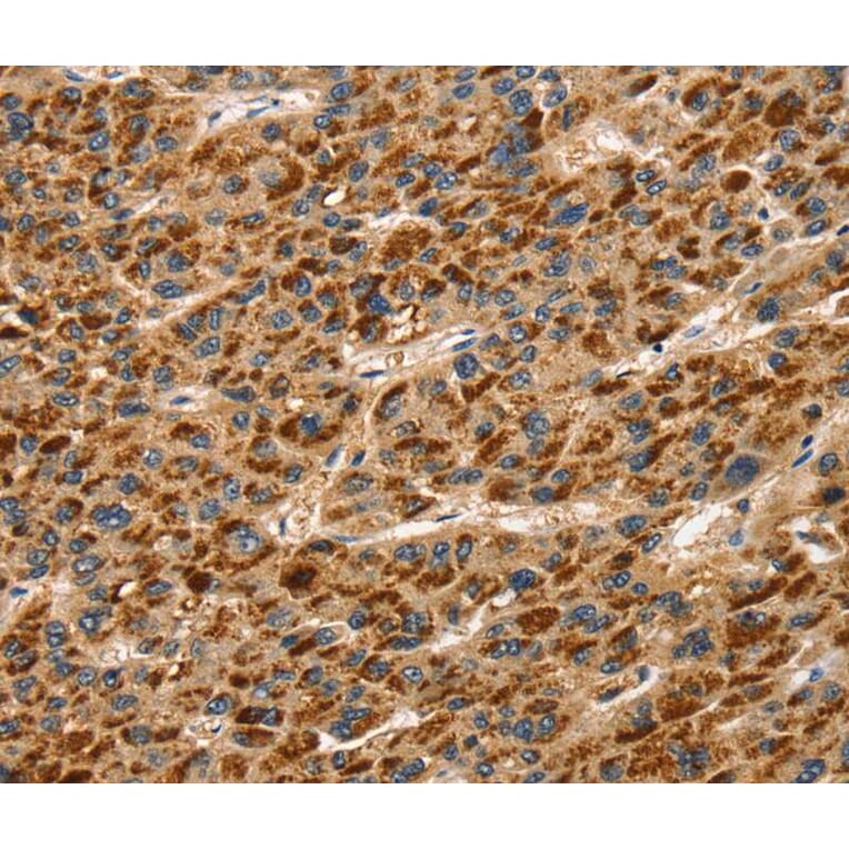Immunohistochemistry - TLN1 Antibody from Signalway Antibody (40235) - Antibodies.com