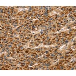 Immunohistochemistry - TLN1 Antibody from Signalway Antibody (40235) - Antibodies.com