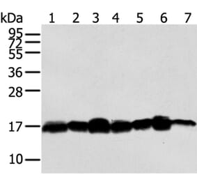 NME2 Antibody from Signalway Antibody (40247) - Antibodies.com