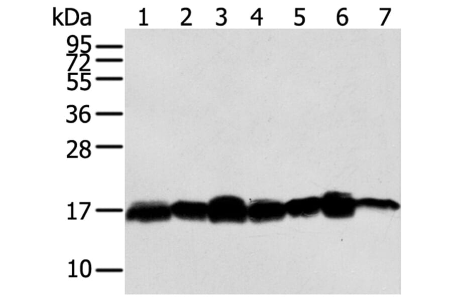 NME2 Antibody from Signalway Antibody (40247) - Antibodies.com