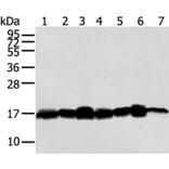 NME2 Antibody from Signalway Antibody (40247) - Antibodies.com