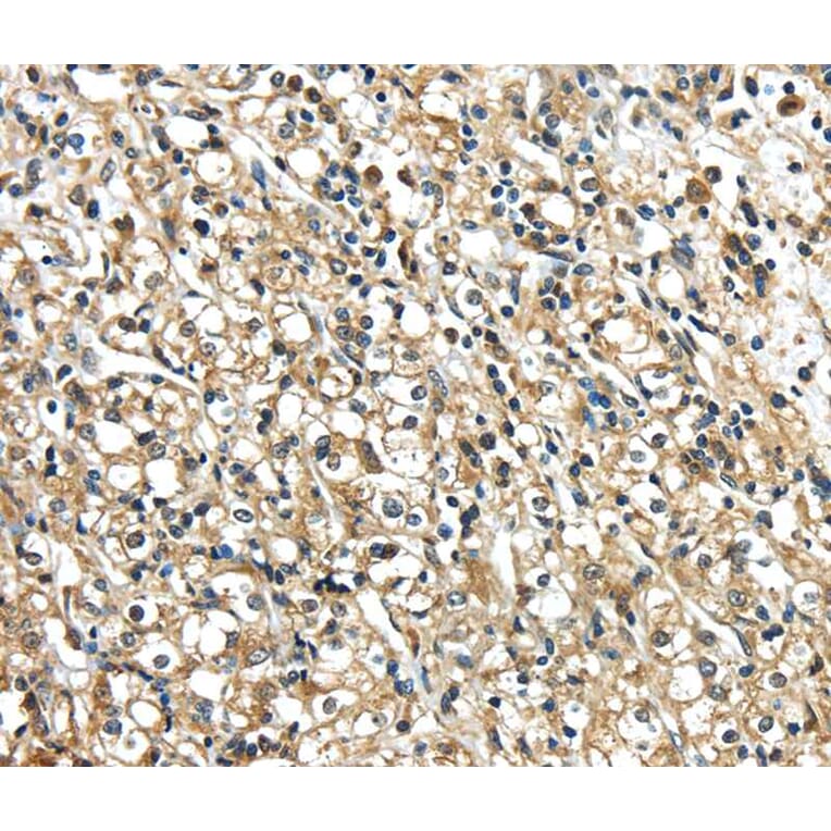 Immunohistochemistry - NME2 Antibody from Signalway Antibody (40247) - Antibodies.com