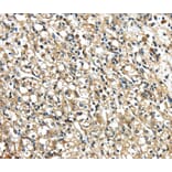 Immunohistochemistry - NME2 Antibody from Signalway Antibody (40247) - Antibodies.com