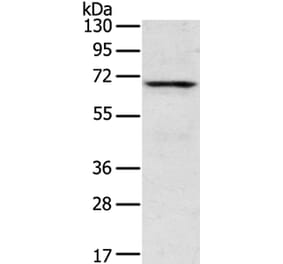 TNK1 Antibody from Signalway Antibody (40259) - Antibodies.com