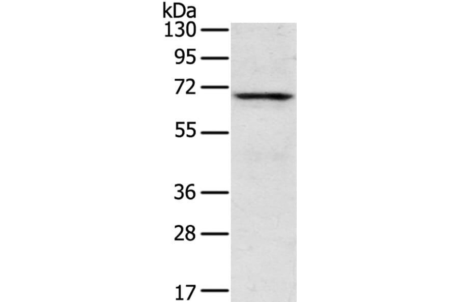 TNK1 Antibody from Signalway Antibody (40259) - Antibodies.com