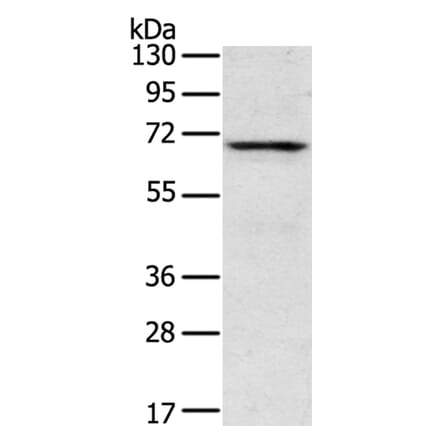 TNK1 Antibody from Signalway Antibody (40259) - Antibodies.com