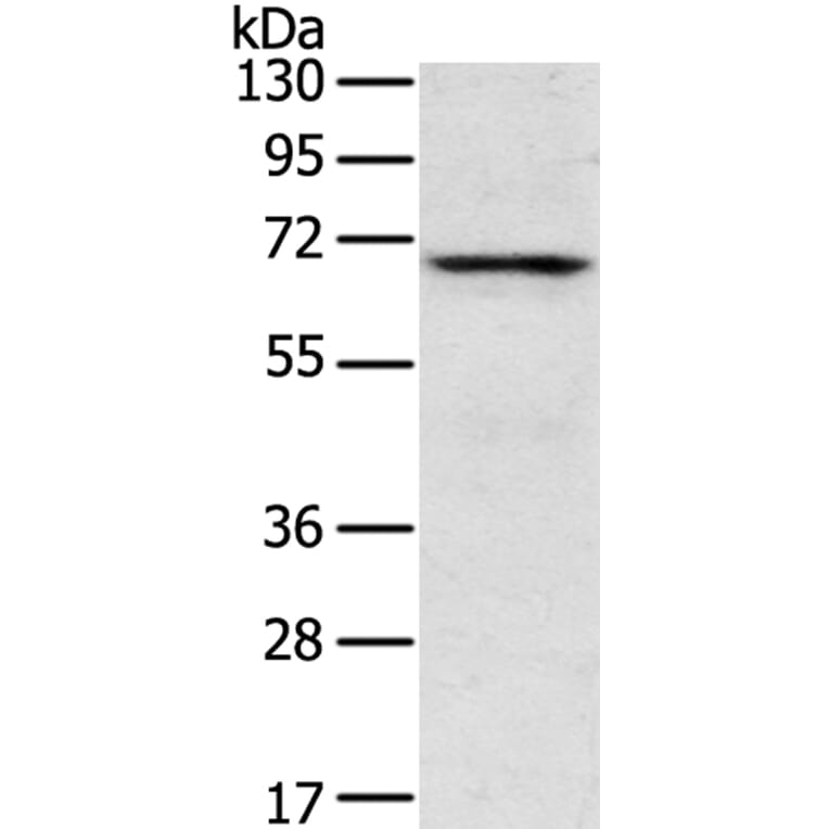TNK1 Antibody from Signalway Antibody (40259) - Antibodies.com