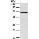 TNK1 Antibody from Signalway Antibody (40259) - Antibodies.com