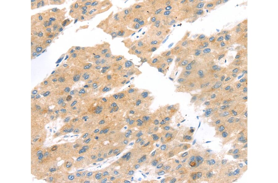 Immunohistochemistry - TNK1 Antibody from Signalway Antibody (40259) - Antibodies.com