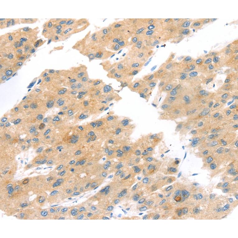 Immunohistochemistry - TNK1 Antibody from Signalway Antibody (40259) - Antibodies.com