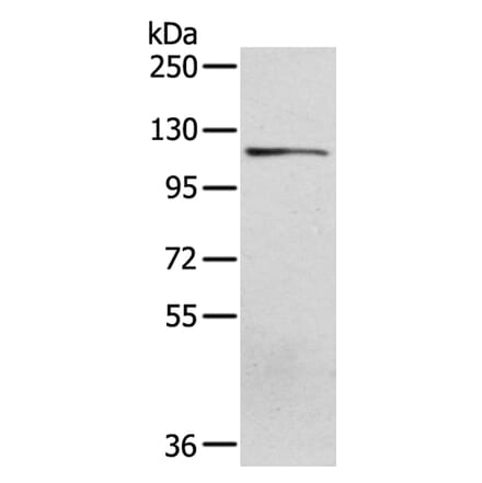 UBA1 Antibody from Signalway Antibody (40277) - Antibodies.com