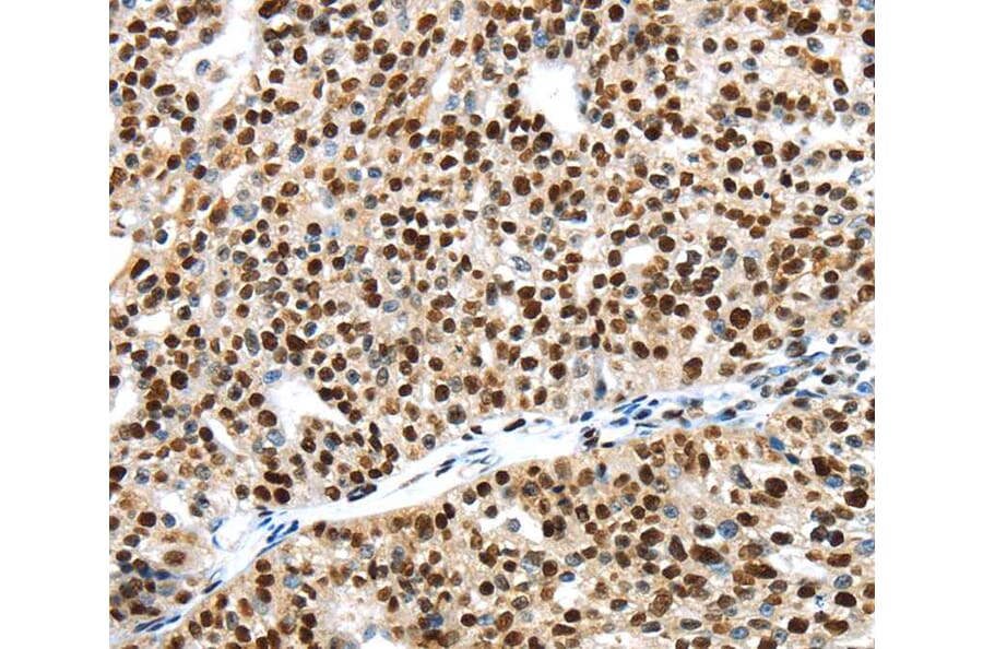 Immunohistochemistry - UBTF Antibody from Signalway Antibody (40278) - Antibodies.com
