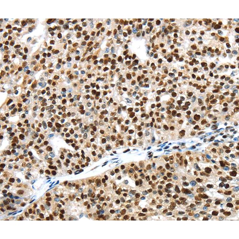 Immunohistochemistry - UBTF Antibody from Signalway Antibody (40278) - Antibodies.com