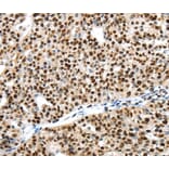 Immunohistochemistry - UBTF Antibody from Signalway Antibody (40278) - Antibodies.com