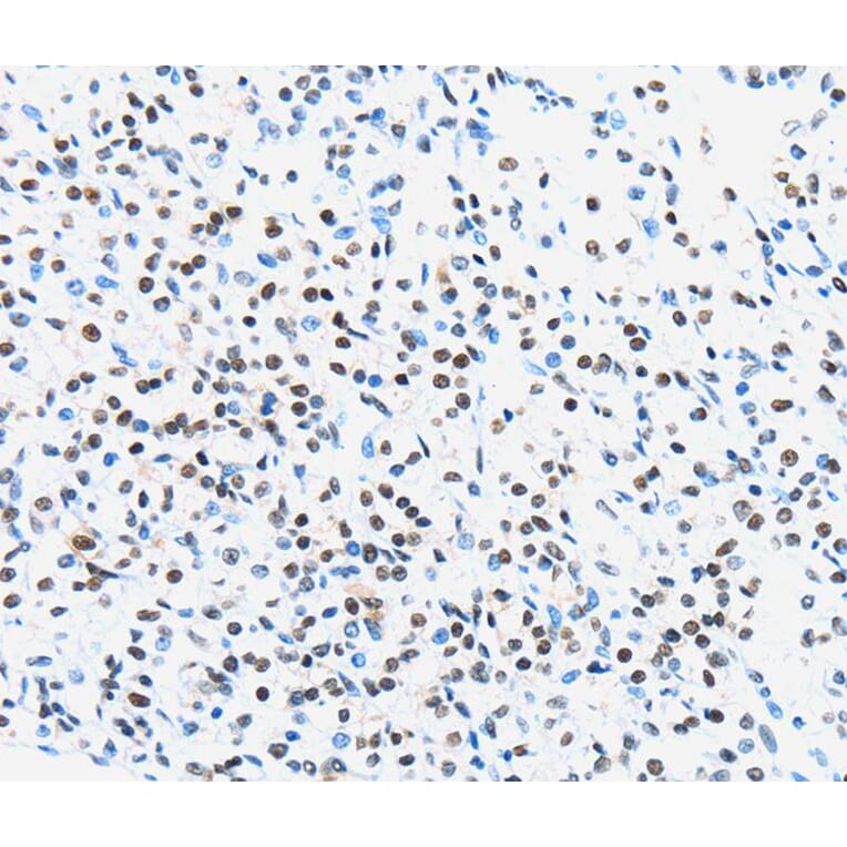 Immunohistochemistry - UBTF Antibody from Signalway Antibody (40278) - Antibodies.com