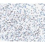 Immunohistochemistry - UBTF Antibody from Signalway Antibody (40278) - Antibodies.com
