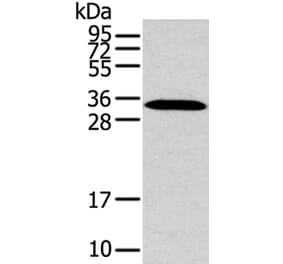 MSI1 Antibody from Signalway Antibody (40281) - Antibodies.com