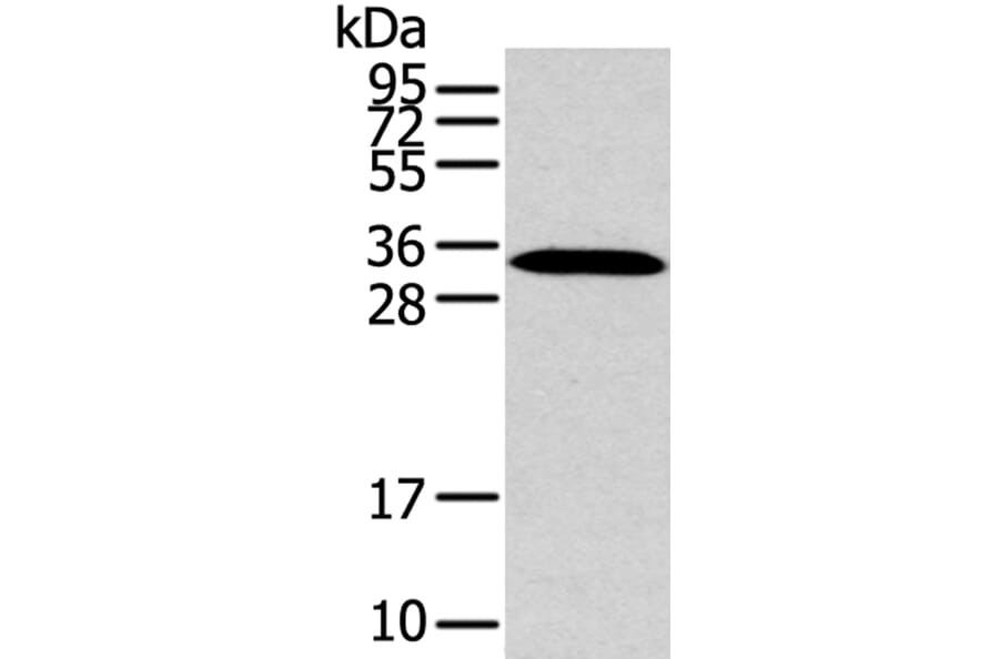 MSI1 Antibody from Signalway Antibody (40281) - Antibodies.com