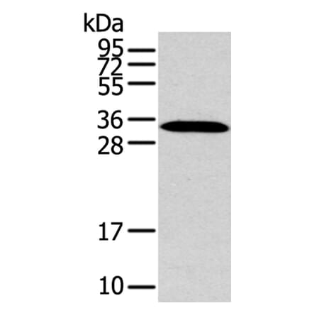 MSI1 Antibody from Signalway Antibody (40281) - Antibodies.com