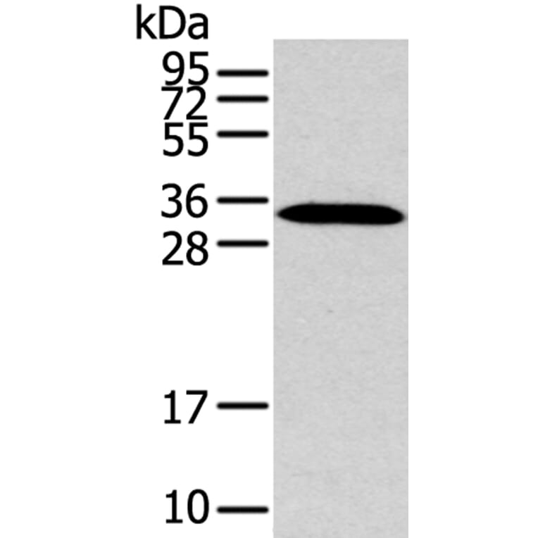 MSI1 Antibody from Signalway Antibody (40281) - Antibodies.com
