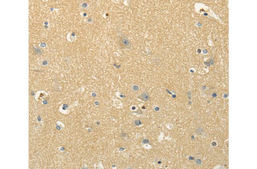 Immunohistochemistry - MSI1 Antibody from Signalway Antibody (40281) - Antibodies.com
