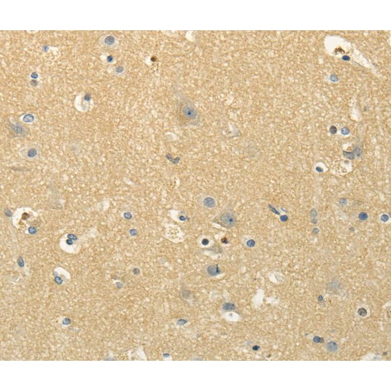 Immunohistochemistry - MSI1 Antibody from Signalway Antibody (40281) - Antibodies.com