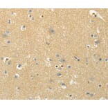 Immunohistochemistry - MSI1 Antibody from Signalway Antibody (40281) - Antibodies.com