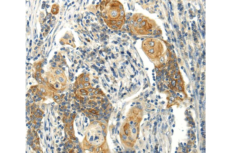 Immunohistochemistry - MSI1 Antibody from Signalway Antibody (40281) - Antibodies.com