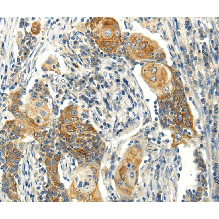 Immunohistochemistry - MSI1 Antibody from Signalway Antibody (40281) - Antibodies.com