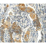 Immunohistochemistry - MSI1 Antibody from Signalway Antibody (40281) - Antibodies.com