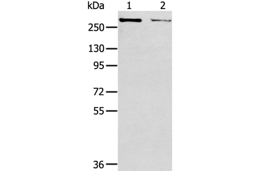WNK2 Antibody from Signalway Antibody (40302) - Antibodies.com