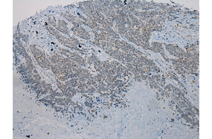 Immunohistochemistry - WNK2 Antibody from Signalway Antibody (40302) - Antibodies.com