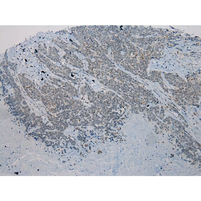 Immunohistochemistry - WNK2 Antibody from Signalway Antibody (40302) - Antibodies.com