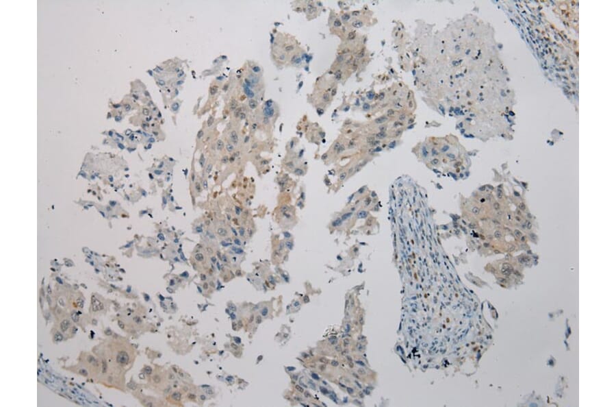 Immunohistochemistry - WNK2 Antibody from Signalway Antibody (40302) - Antibodies.com