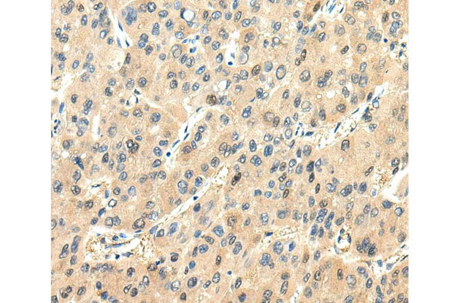 Immunohistochemistry - CHGA Antibody from Signalway Antibody (40307) - Antibodies.com