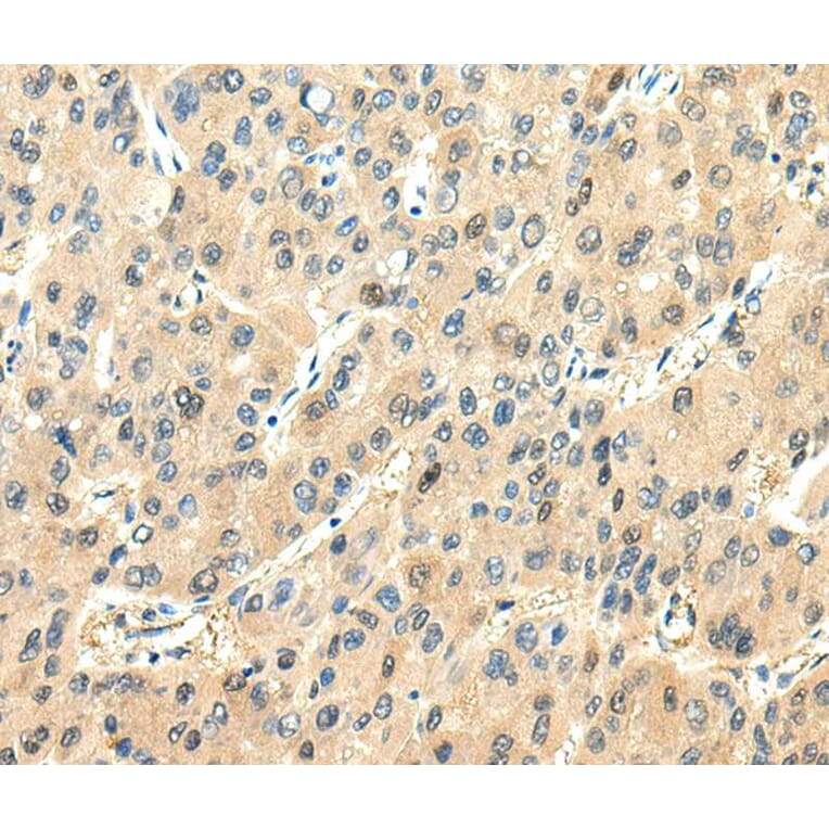 Immunohistochemistry - CHGA Antibody from Signalway Antibody (40307) - Antibodies.com