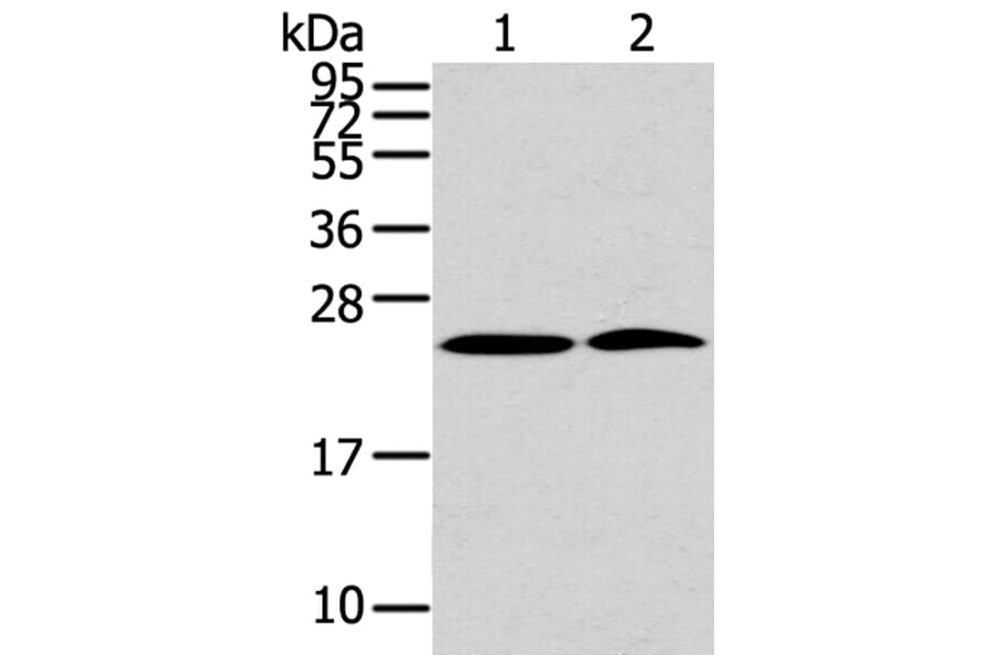 PDPN Antibody from Signalway Antibody (40308) - Antibodies.com