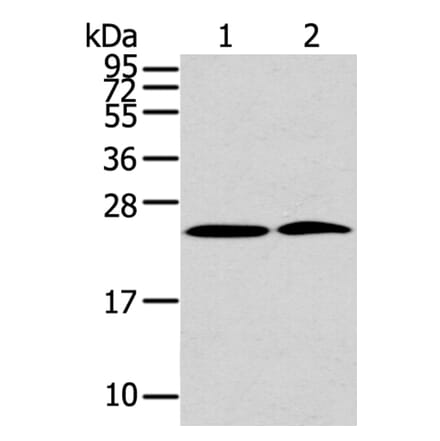 PDPN Antibody from Signalway Antibody (40308) - Antibodies.com